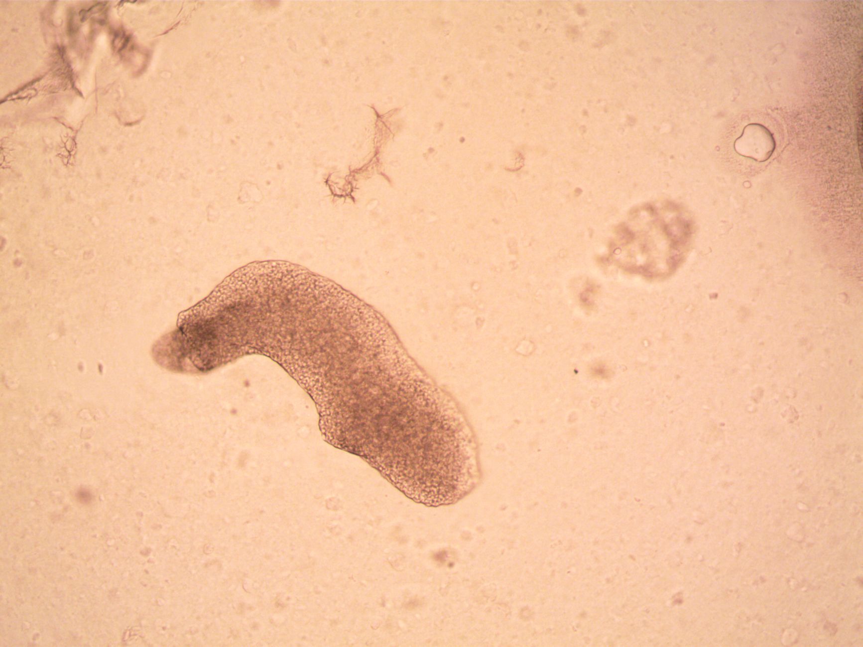 Heat tolerance amoeba: What makes it the best at surviving?